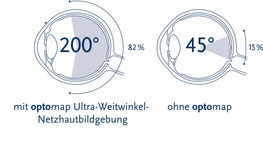 auge darstellung